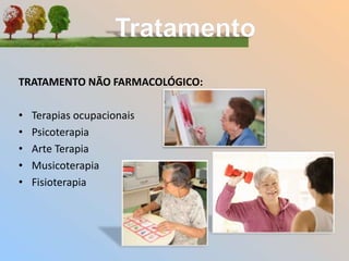 TRATAMENTO NÃO FARMACOLÓGICO:
• Terapias ocupacionais
• Psicoterapia
• Arte Terapia
• Musicoterapia
• Fisioterapia
 