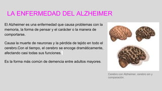 LA ENFERMEDAD DEL ALZHEIMER
El Alzheimer es una enfermedad que causa problemas con la
memoria, la forma de pensar y el carácter o la manera de
comportarse.
Causa la muerte de neuronas y la pérdida de tejido en todo el
cerebro.Con el tiempo, el cerebro se encoge dramáticamente,
afectando casi todas sus funciones.
Es la forma más común de demencia entre adultos mayores.
Cerebro con Alzheimer, cerebro sin y
comparación.
 