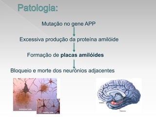 Patologia:Mutação no gene APPExcessivaproduçãodaproteínaamilóideFormação de placasamilóidesBloqueioemorte dos neuróniosadjacentes