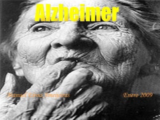 Alzheimer Manuel Eiroa Ameijeiras  Enero 2009 