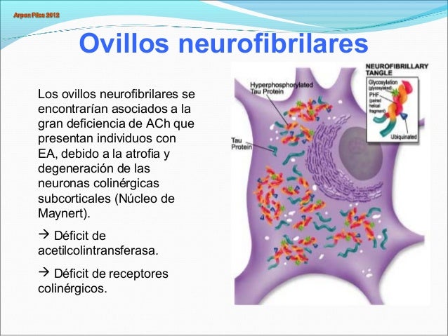 Alzheimer ppt1