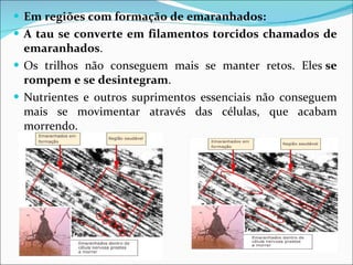 Em regiões com formação de emaranhados: A tau se converte em filamentos torcidos chamados de emaranhados . Os trilhos não conseguem mais se manter retos. Eles  se rompem e se desintegram . Nutrientes e outros suprimentos essenciais não conseguem mais se movimentar através das células, que acabam morrendo.  