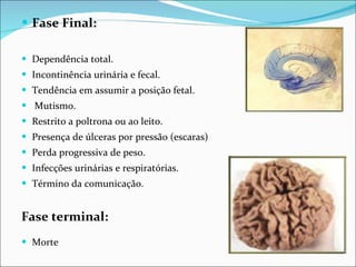 Fase Final:  Dependência total. Incontinência urinária e fecal. Tendência em assumir a posição fetal. Mutismo. Restrito a poltrona ou ao leito. Presença de úlceras por pressão (escaras) Perda progressiva de peso. Infecções urinárias e respiratórias. Término da comunicação. Fase terminal: Morte 