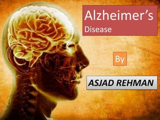 Alzheimer’s
Disease
By
ASJAD REHMAN
 