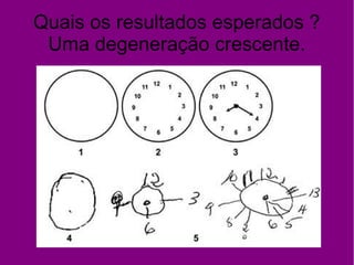 Quais os resultados esperados ?
Uma degeneração crescente.
 