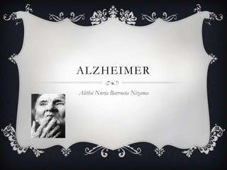 ALZHEIMER
Alithú Nuria Barrueta Nizama
 