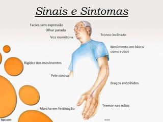 Sinais e Sintomas
 
