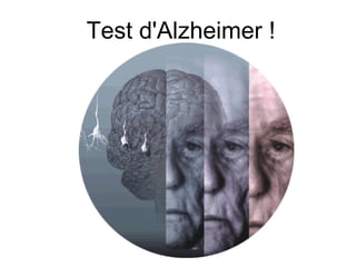 Test d'Alzheimer !   