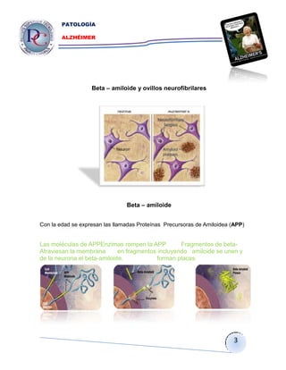 PATOLOGÍA

        ALZHÉIMER




                   Beta – amiloide y ovillos neurofibrilares




                                Beta – amiloide


Con la edad se expresan las llamadas Proteínas Precursoras de Amiloidea (APP)


Las moléculas de APPEnzimas rompen la APP          Fragmentos de beta-
Atraviesan la membrana       en fragmentos incluyendo amiloide se unen y
de la neurona.el beta-amiloide.           forman placas.




                                                                         3
 