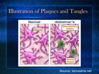 Illustration of Plaques and Tangles Source: lancastria.net 
