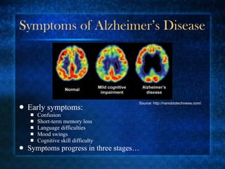 Symptoms of Alzheimer’s Disease Early symptoms: Confusion Short-term memory loss Language difficulties Mood swings Cognitive skill difficulty Symptoms progress in three stages… Source: http://nanobiotechnews.com/ 