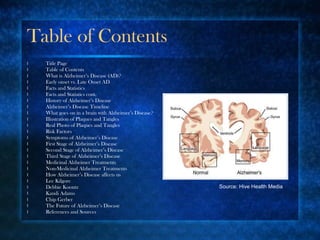 Table of Contents Title Page Table of Contents What is Alzheimer’s Disease (AD)? Early onset vs. Late Onset AD Facts and Statistics Facts and Statistics cont. History of Alzheimer’s Disease Alzheimer’s Disease Timeline What goes on in a brain with Alzheimer’s Disease? Illustration of Plaques and Tangles Real Photo of Plaques and Tangles Risk Factors Symptoms of Alzheimer’s Disease First Stage of Alzheimer’s Disease Second Stage of Alzheimer’s Disease Third Stage of Alzheimer’s Disease Medicinal Alzheimer Treatments Non-Medicinal Alzheimer Treatments How Alzheimer’s Disease affects us Lee Kilgore Debbie Koontz Kandi Adams Chip Gerber The Future of Alzheimer’s Disease References and Sources Source: Hive Health Media 