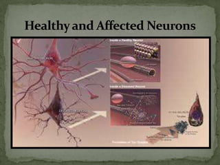 Healthy and Affected Neurons

 