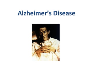 Alzheimer’s Disease 