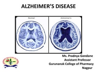 ALZHEIMER’S DISEASE
Ms. Pradnya Gondane
Assistant Professor
Gurunanak College of Pharmacy
Nagpur
 