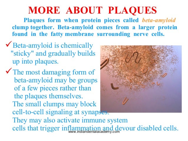 alzheimers disease a new approach how does plaque form