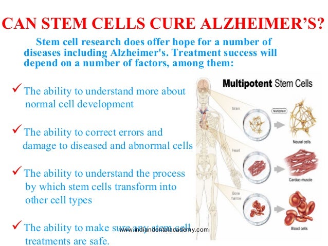 the causes and potential cure for alzheimers disease Alzheimer’s disease and cadasil are heritable, adult-onset dementias that both involve damaged small blood vessels as i sit each morning, reading articles in reference to alzheimer’s i become more discouraged that they haven’t found a treatment or cure for this brain disease after all these years with research and wasted funds. the causes and potential cure for alzheimers disease Alzheimer’s disease and cadasil are heritable, adult-onset dementias that both involve damaged small blood vessels as i sit each morning, reading articles in reference to alzheimer’s i become more discouraged that they haven’t found a treatment or cure for this brain disease after all these years with research and wasted funds.