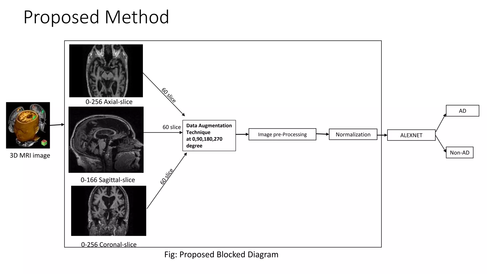 Alzheimer's disease classification using Deep learning Neural a Network ...