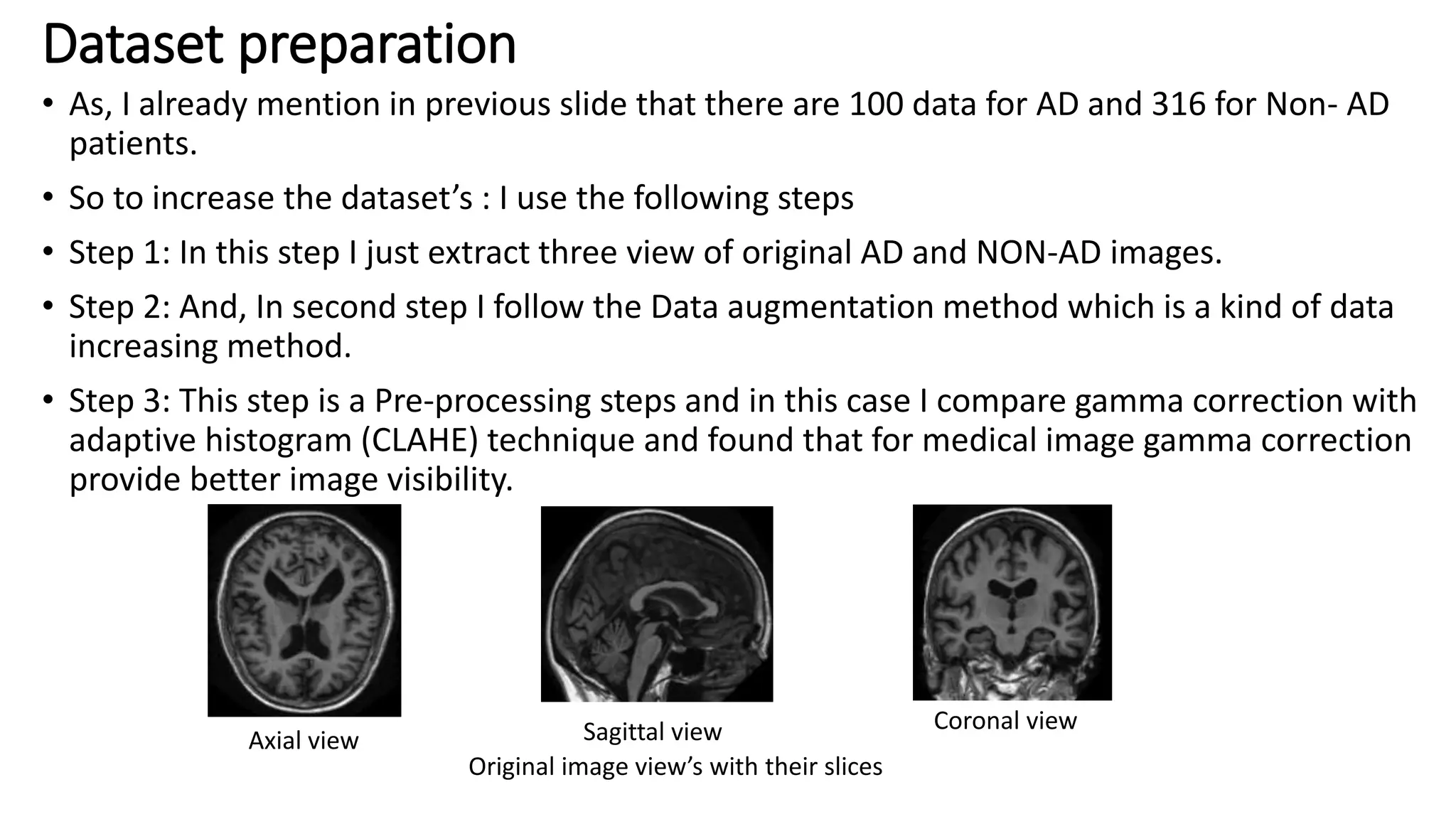 Alzheimer's disease classification using Deep learning Neural a Network ...