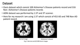 Alzheimer's disease classification using Deep learning Neural a Network ...