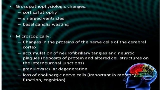 alzheimers disease ppt alzheimer s disease ppt