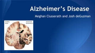 Alzheimer’s Disease
Meghan Clusserath and Josh deGuzman
 