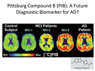 Pathophysiology: Alzheimer's Disease | PPTX