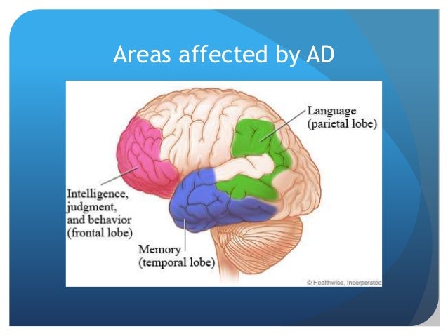 Alzehmers research proposal ideas