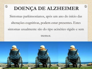 DOENÇA DE ALZHEIMER
Sintomas parkinsonianos, após um ano do início das
alterações cognitivas, podem estar presentes. Estes
sintomas usualmente são do tipo acinético rígido e sem
tremor.
 