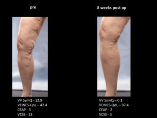 VCSS: Adds Sophistication | PPTX