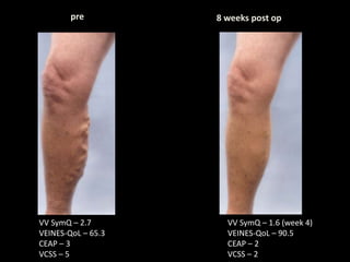 VCSS: Adds Sophistication | PPTX
