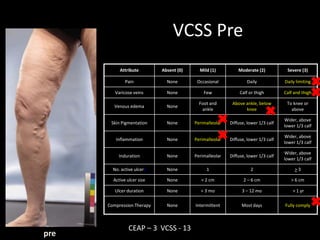 VCSS: Adds Sophistication | PPTX