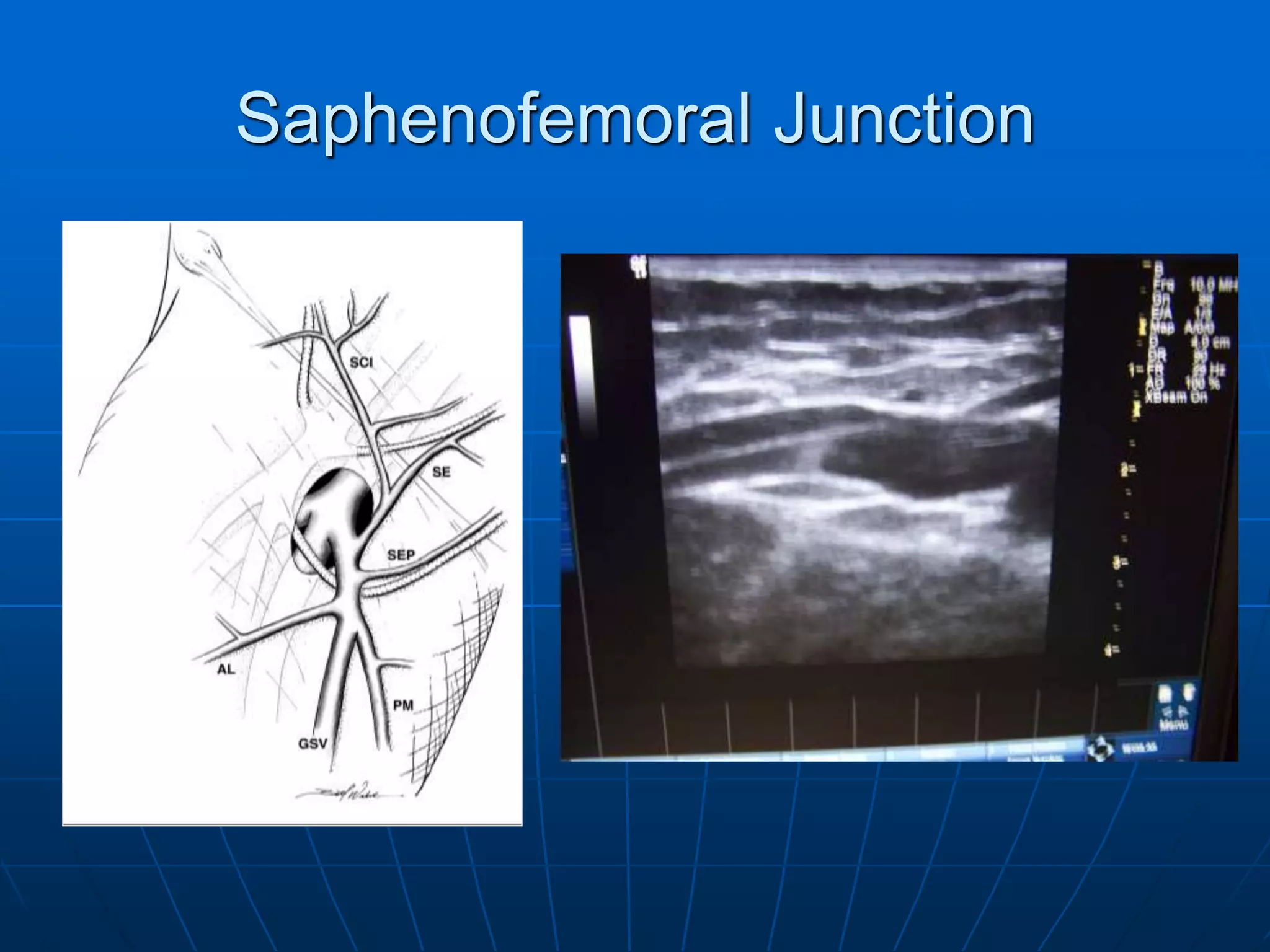 the-great-saphenous-vein-pdf