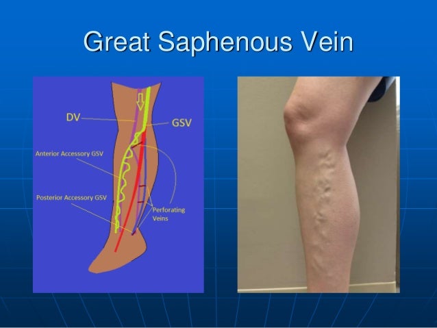 The Great Saphenous Vein