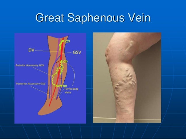 The Great Saphenous Vein