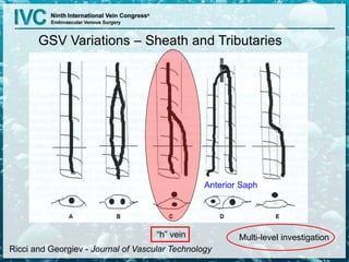 GSV Variations – Sheath and Tributaries
Ricci and Georgiev - Journal of Vascular Technology
“h” vein
Anterior Saph
Multi-level investigation
 