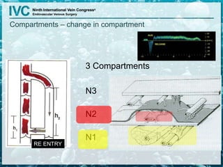 Compartments – change in compartment
 3 Compartments
 N3
 N2
 N1
EXIT
RE ENTRY
 