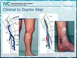 Clinical to Duplex Map
 