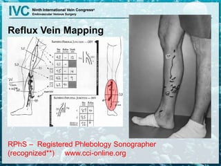 Reflux Vein Mapping
RPhS – Registered Phlebology Sonographer
(recognized**) www.cci-online.org
 