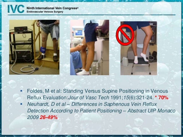 Duplex for Superficial Venous Disease