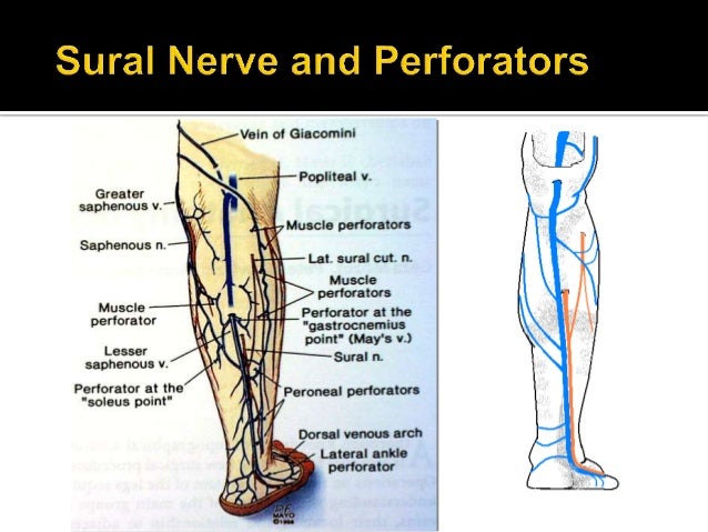 SSV: Anatomy & Pathophysiology