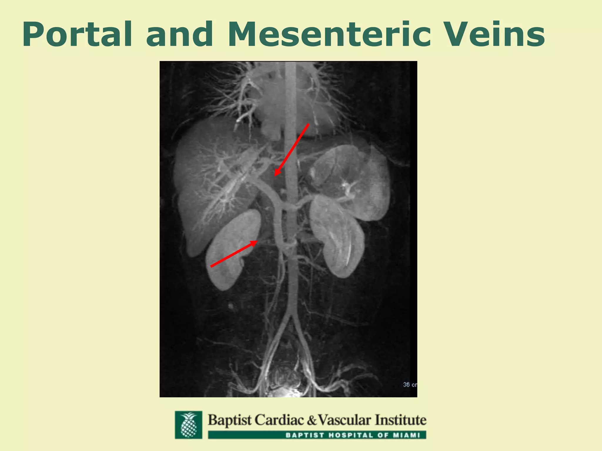 Portal and Mesenteric Veins
 