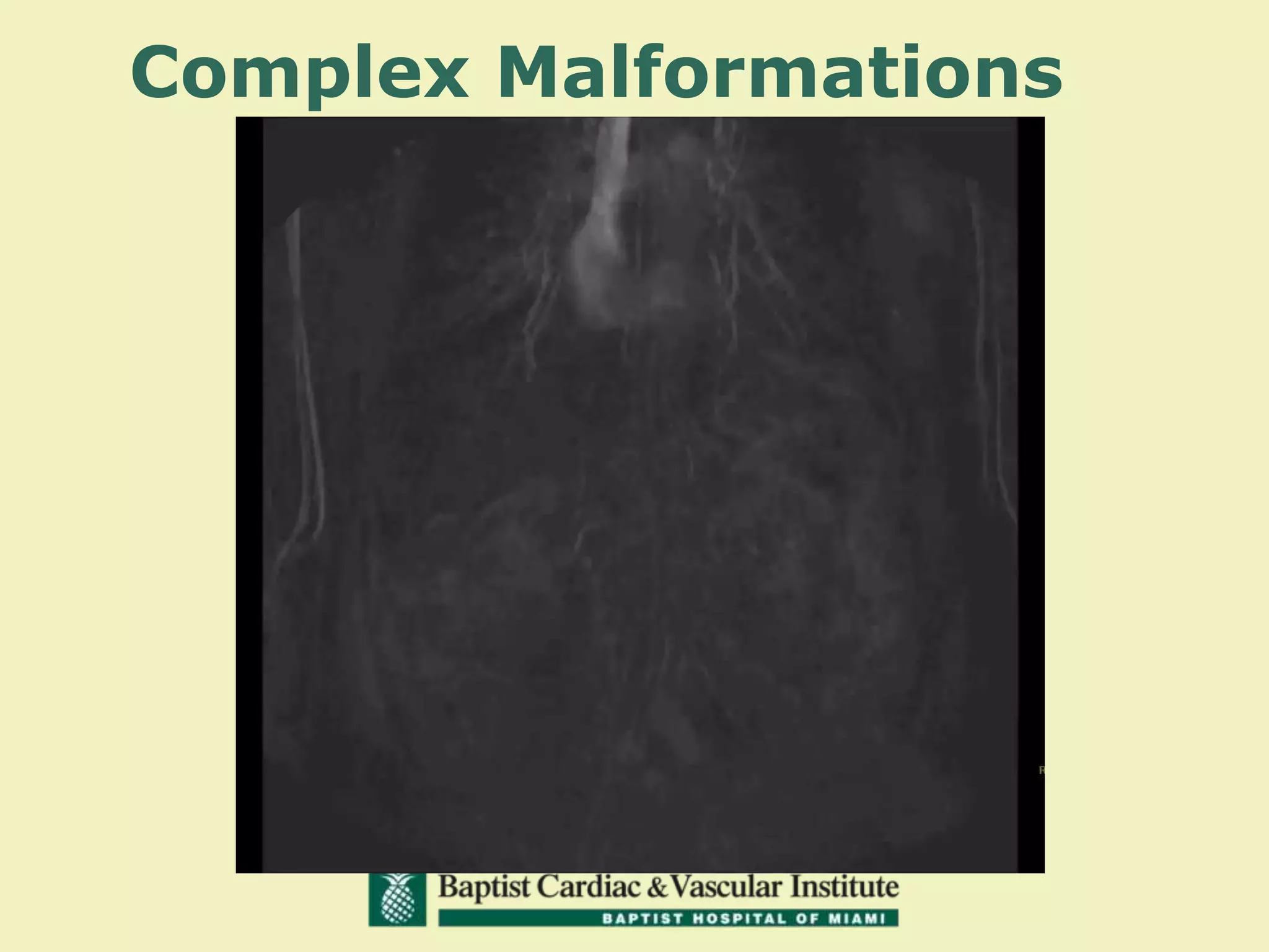 Complex Malformations
 