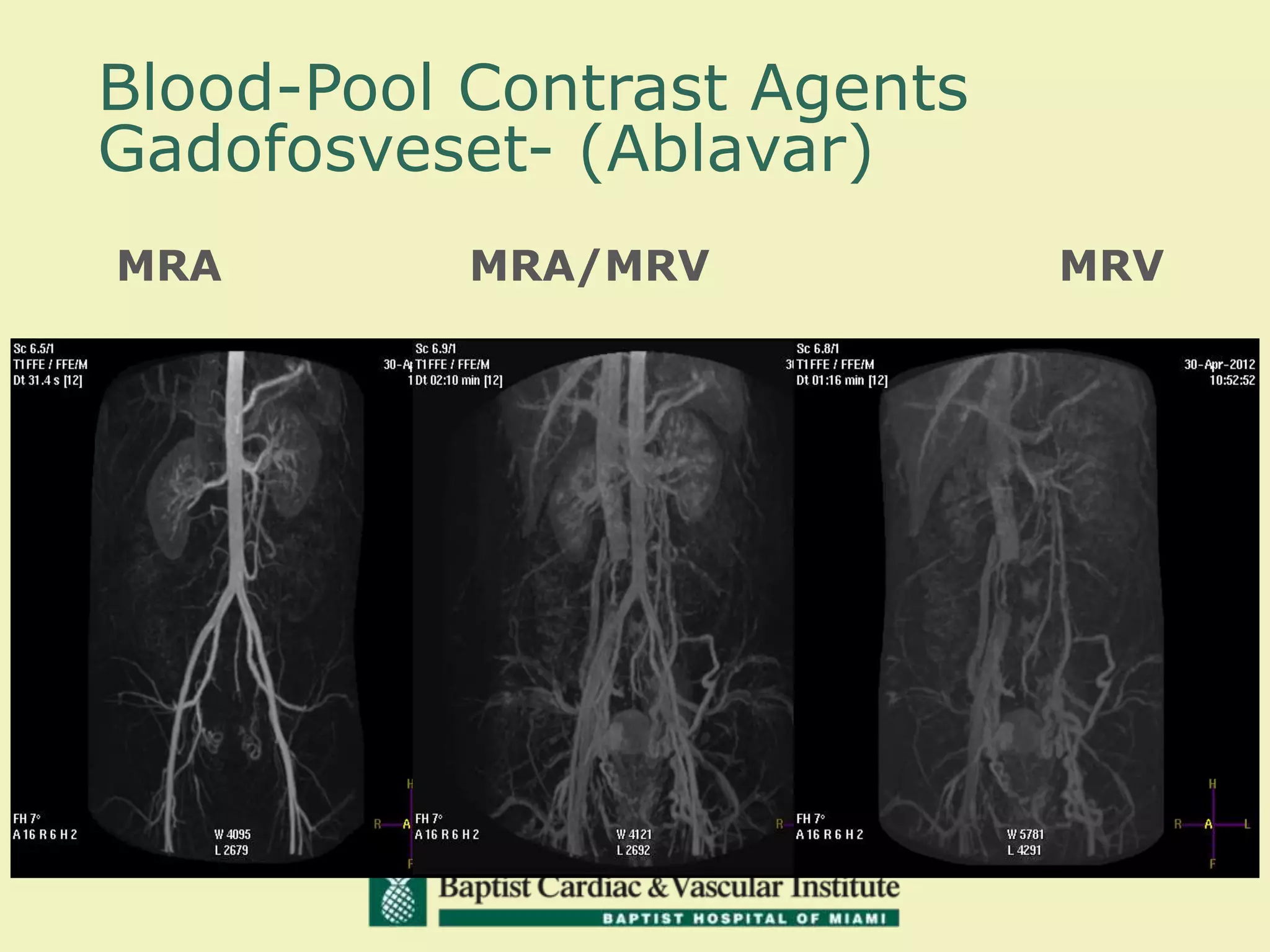 MRA MRA/MRV MRV
Blood-Pool Contrast Agents
Gadofosveset- (Ablavar)
 