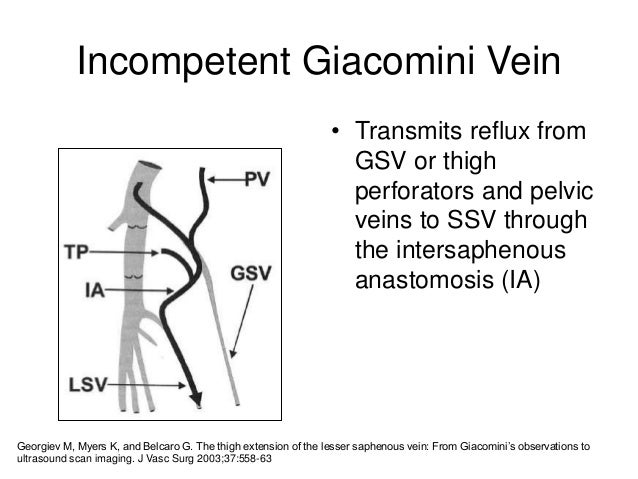 What is the vein of giacomini