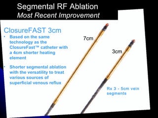 Future of RF Ablation: Continuous or Segmental? | PPT