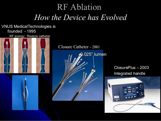 ablation high frequency Ablation: Continuous RF or Future Segmental? of ablation high frequency Ablation: Continuous RF or Future Segmental? of