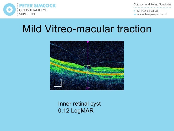A Macular Pathology And Oct Update For Optometrists A Macular Pathology And Oct Update For Optometrists