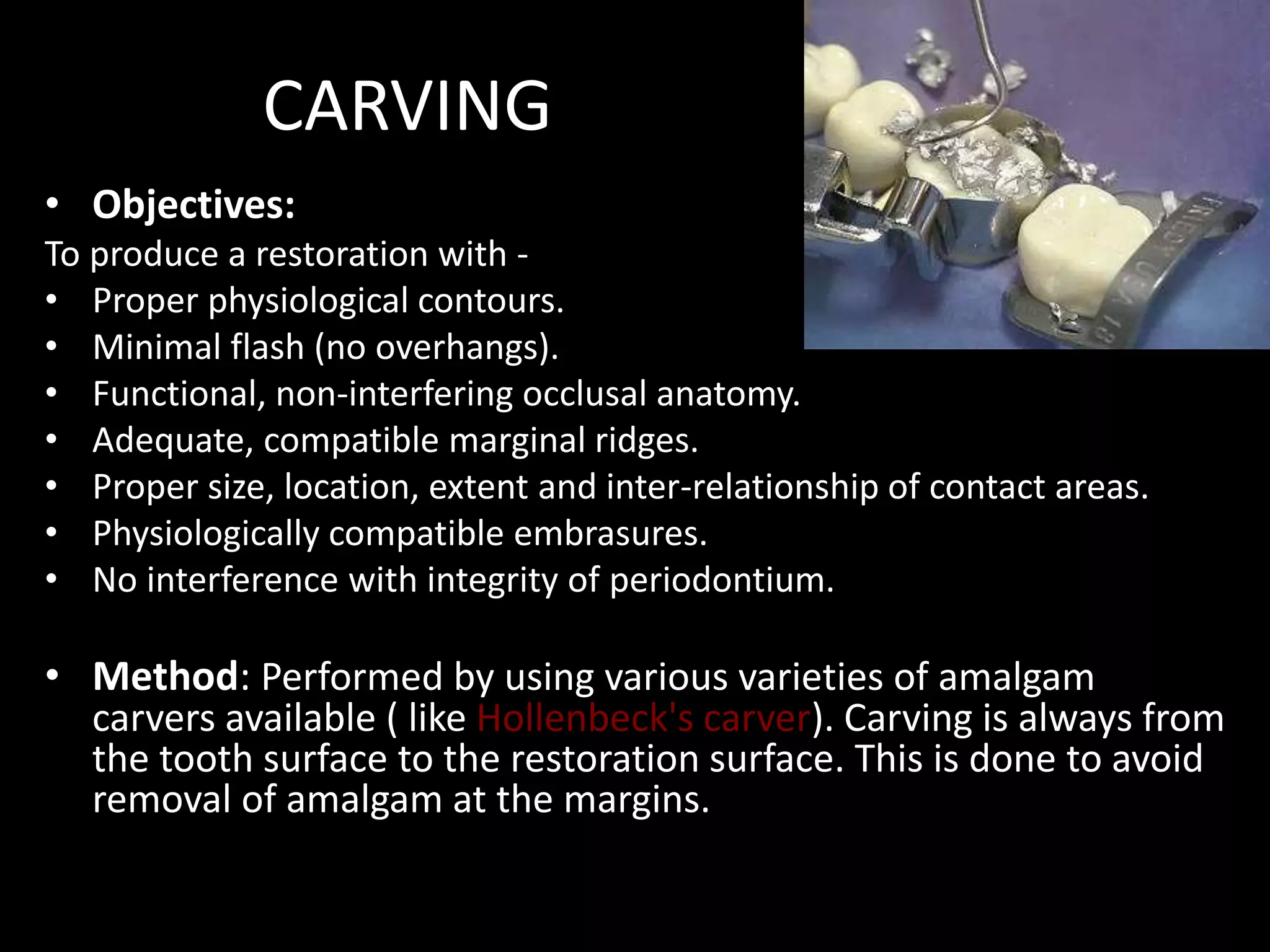 CARVING
• Objectives:
To produce a restoration with -
• Proper physiological contours.
• Minimal flash (no overhangs).
• Functional, non-interfering occlusal anatomy.
• Adequate, compatible marginal ridges.
• Proper size, location, extent and inter-relationship of contact areas.
• Physiologically compatible embrasures.
• No interference with integrity of periodontium.
• Method: Performed by using various varieties of amalgam
carvers available ( like Hollenbeck's carver). Carving is always from
the tooth surface to the restoration surface. This is done to avoid
removal of amalgam at the margins.
 
