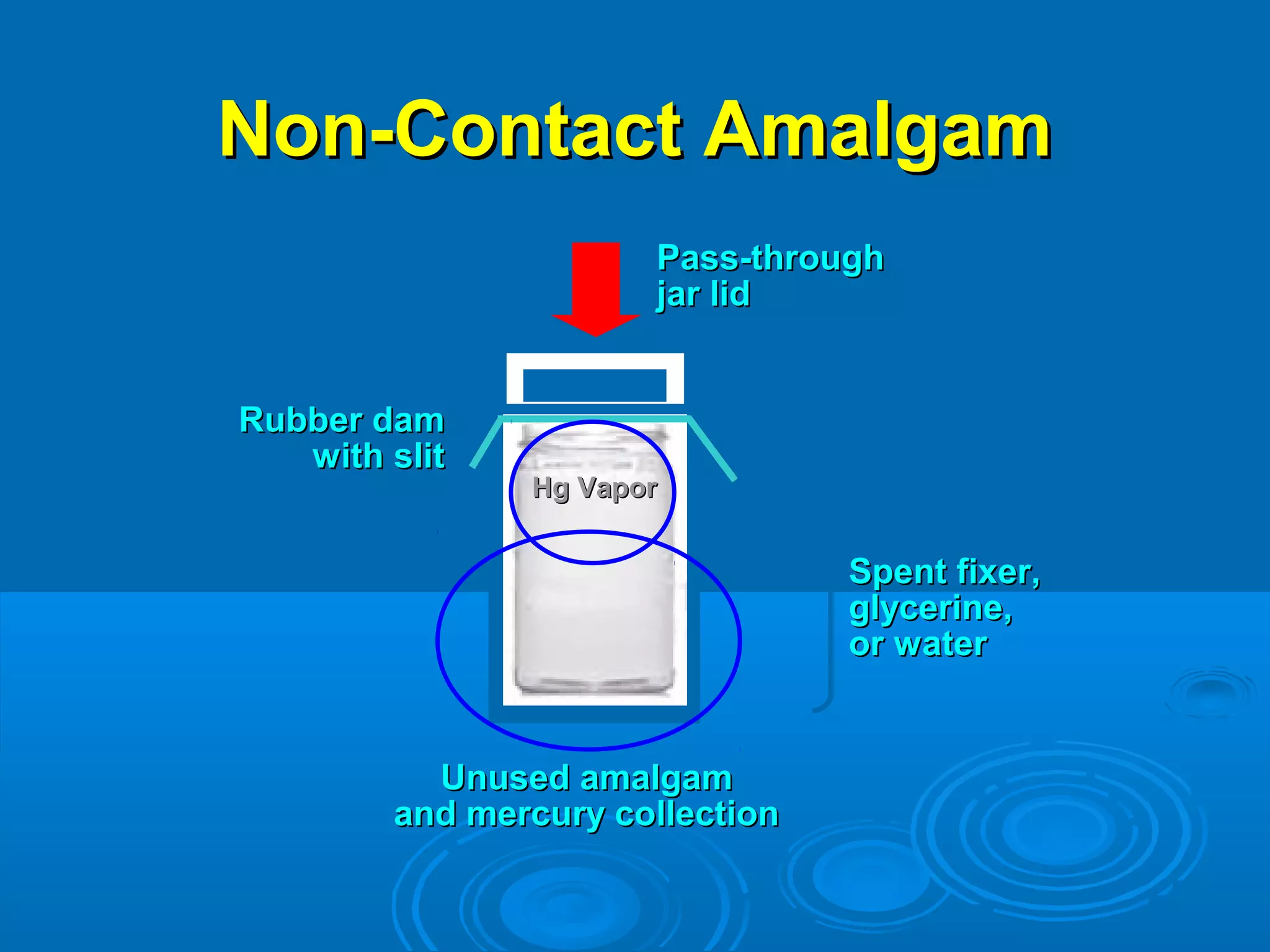 NNoonn--CCoonnttaacctt AAmmaallggaamm 
PPaassss--tthhrroouugghh 
jjaarr lliidd 
SSppeenntt ffiixxeerr,, 
ggllyycceerriinnee,, 
oorr wwaatteerr 
RRuubbbbeerr ddaamm 
wwiitthh sslliitt 
HHgg VVaappoorr 
UUnnuusseedd aammaallggaamm 
aanndd mmeerrccuurryy ccoolllleeccttiioonn 
 